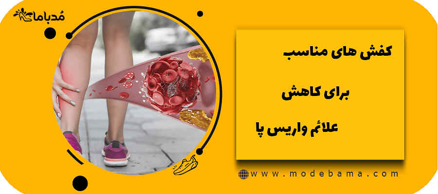 کفش های مناسب برای کاهش علائم واریس پا